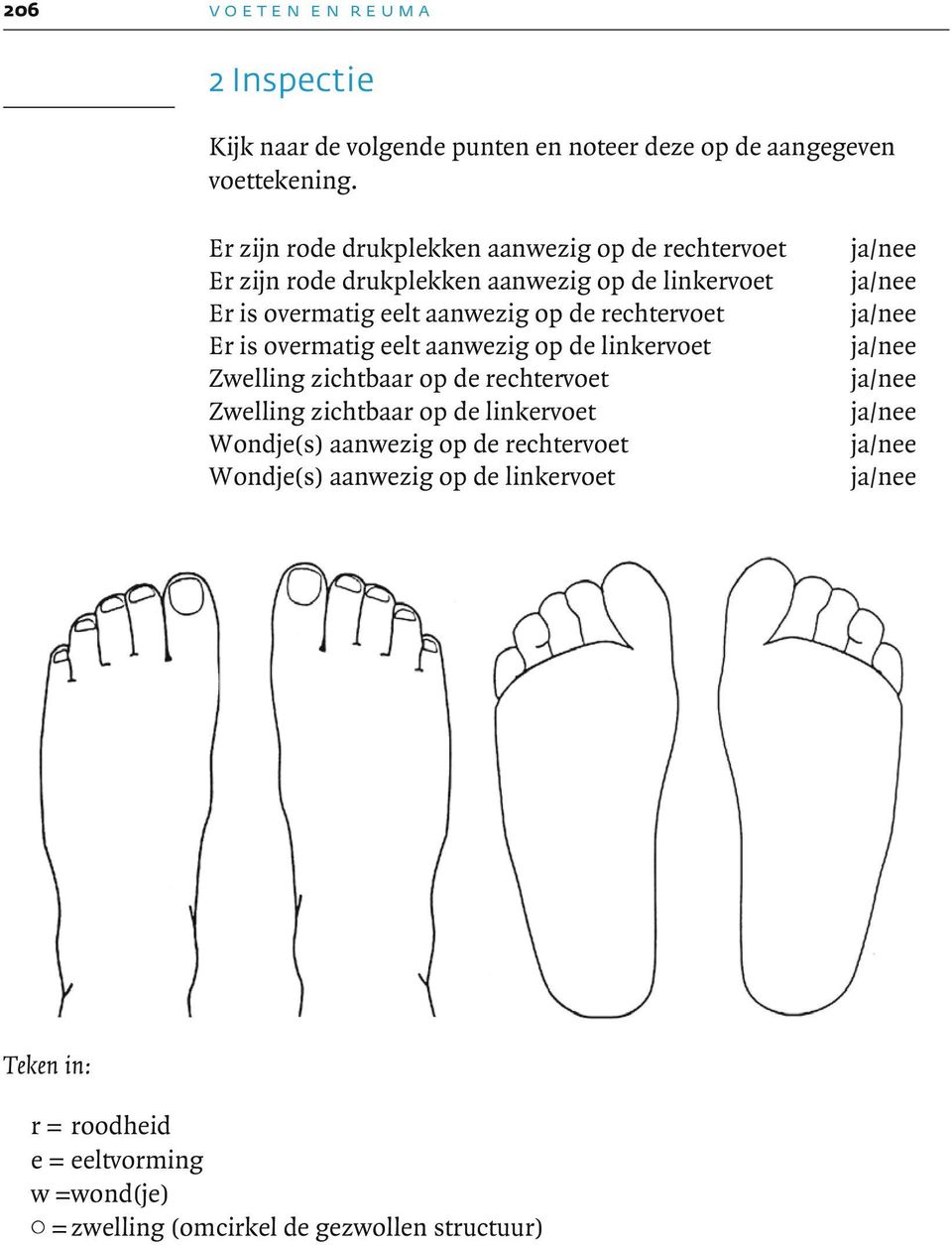 artralgie voeten închiderea articulației genunchiului