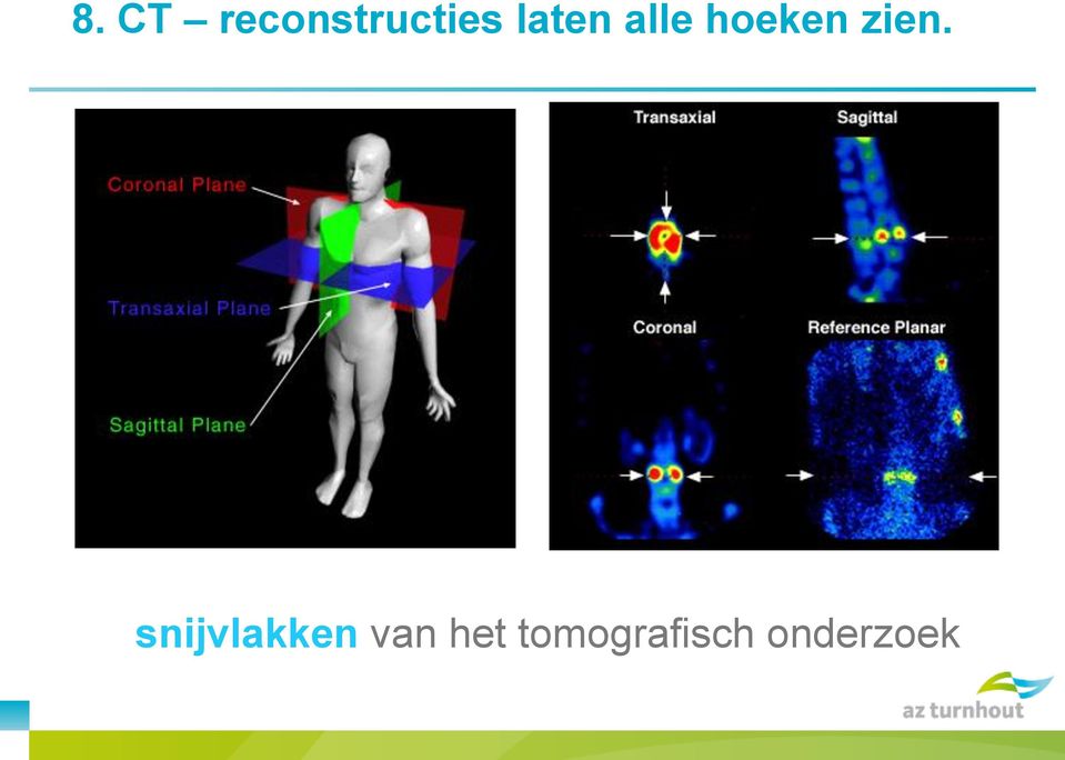 zien. snijvlakken van