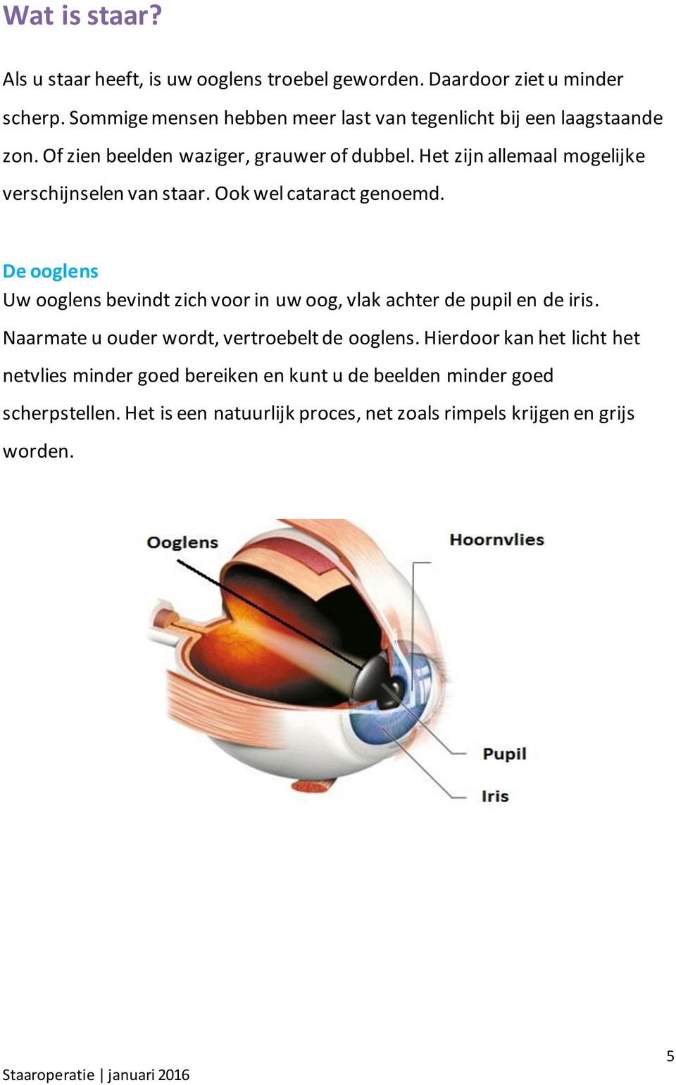 Het zijn allemaal mogelijke verschijnselen van staar. Ook wel cataract genoemd.