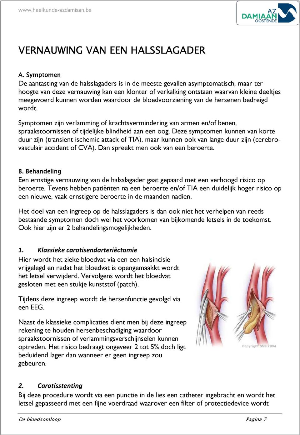 kunnen worden waardoor de bloedvoorziening van de hersenen bedreigd wordt.