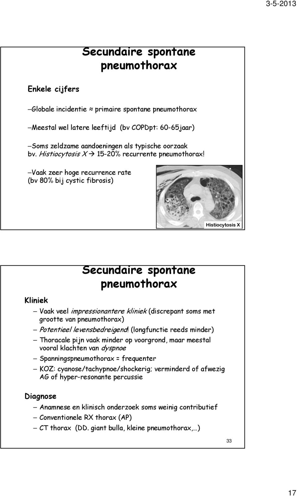 Vaak zeer hoge recurrence rate (bv 80% bij cystic fibrosis) 32 Histiocytosis X Secundaire spontane pneumothorax Kliniek Vaak veel impressionantere kliniek (discrepant soms met grootte van