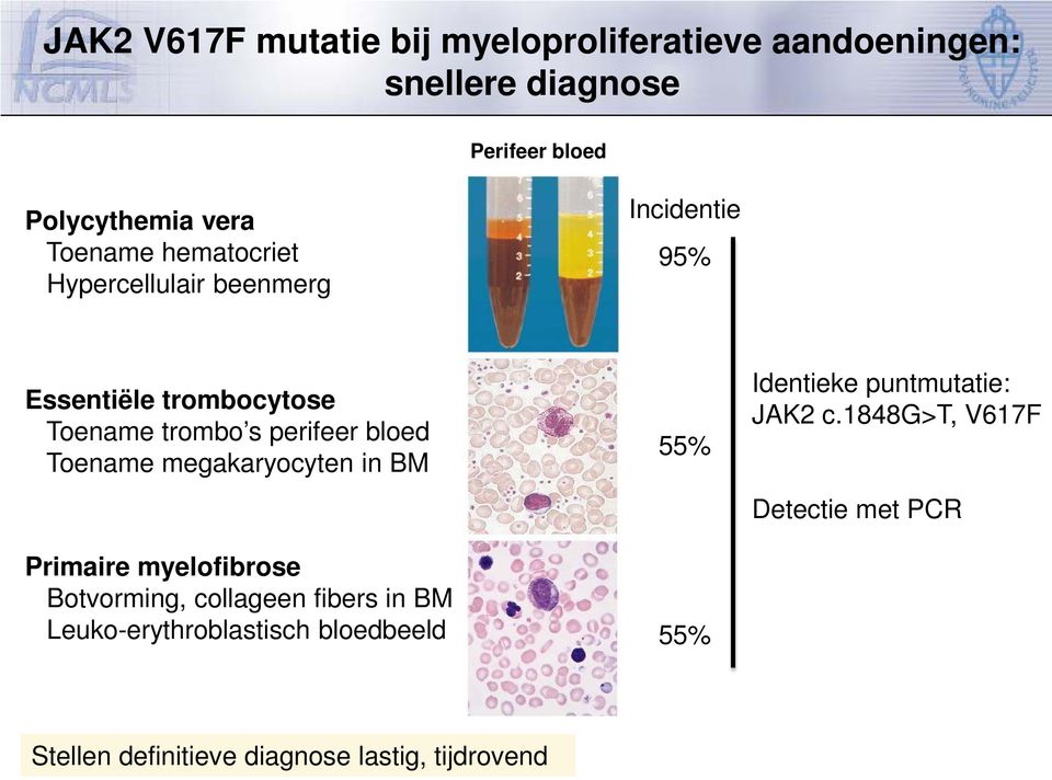 Toename megakaryocyten in BM Primaire myelofibrose Botvorming, collageen fibers in BM Leuko-erythroblastisch