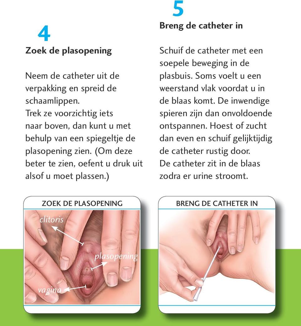 (Om deze beter te zien, oefent u druk uit alsof u moet plassen.) 5 breng de catheter in Schuif de catheter met een soepele beweging in de plasbuis.