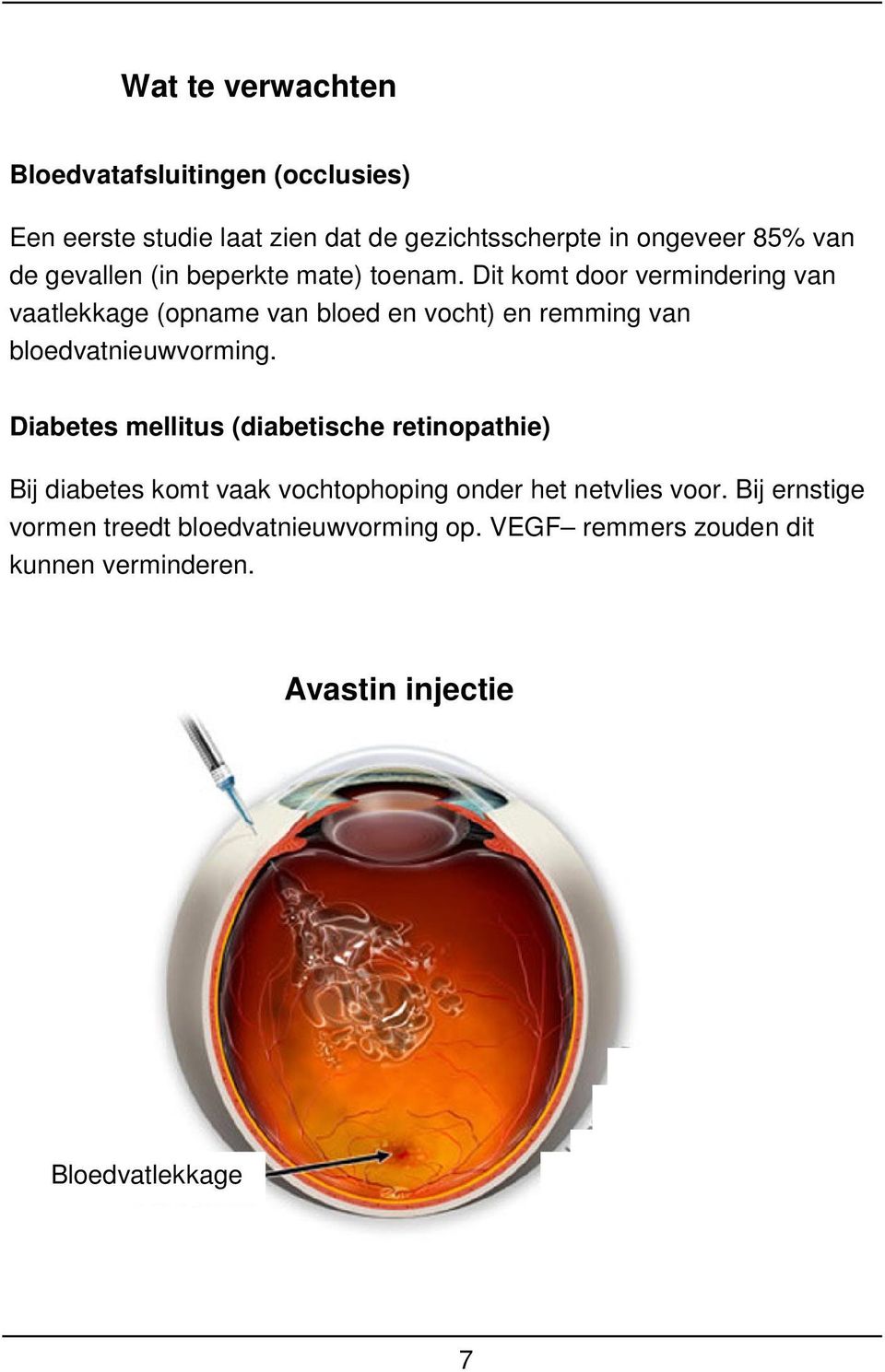 Dit komt door vermindering van vaatlekkage (opname van bloed en vocht) en remming van bloedvatnieuwvorming.