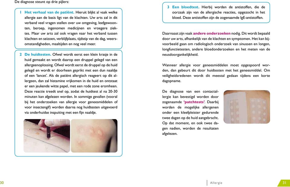 Maar uw arts zal ook vragen naar het verband tussen klachten en seizoen, verblijfplaats, tijdstip van de dag, weersomstandigheden, maaltijden en nog veel meer. 2 De huidtesten.