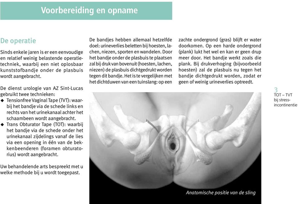TOT TVT bij stressincontinentie Dienst urologie, andrologie en steenkliniek  - PDF Gratis download