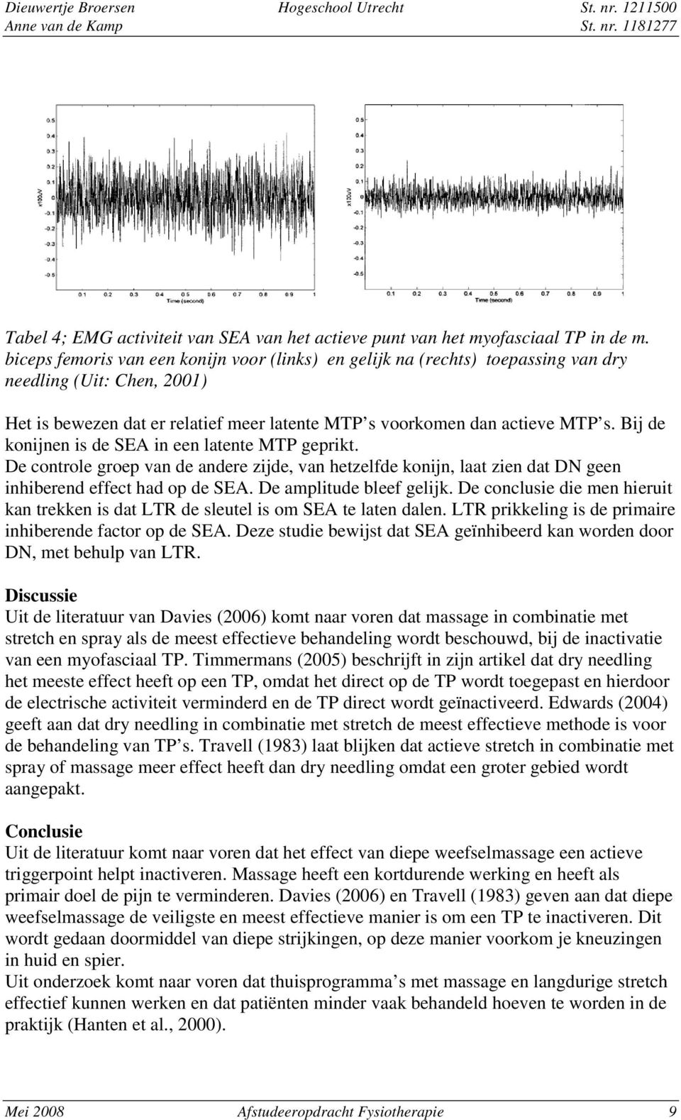 Bij de konijnen is de SEA in een latente MTP geprikt. De controle groep van de andere zijde, van hetzelfde konijn, laat zien dat DN geen inhiberend effect had op de SEA. De amplitude bleef gelijk.