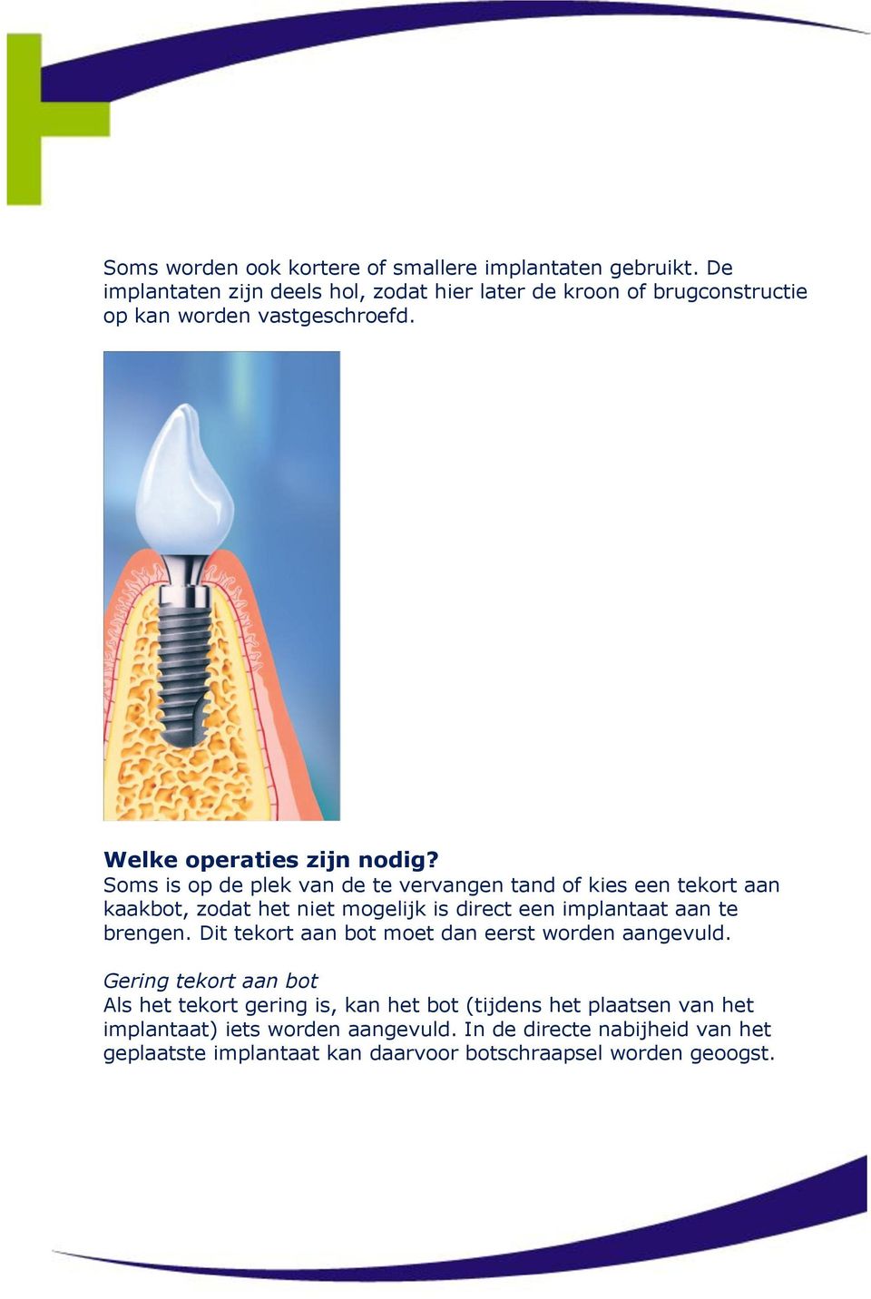 Soms is op de plek van de te vervangen tand of kies een tekort aan kaakbot, zodat het niet mogelijk is direct een implantaat aan te brengen.