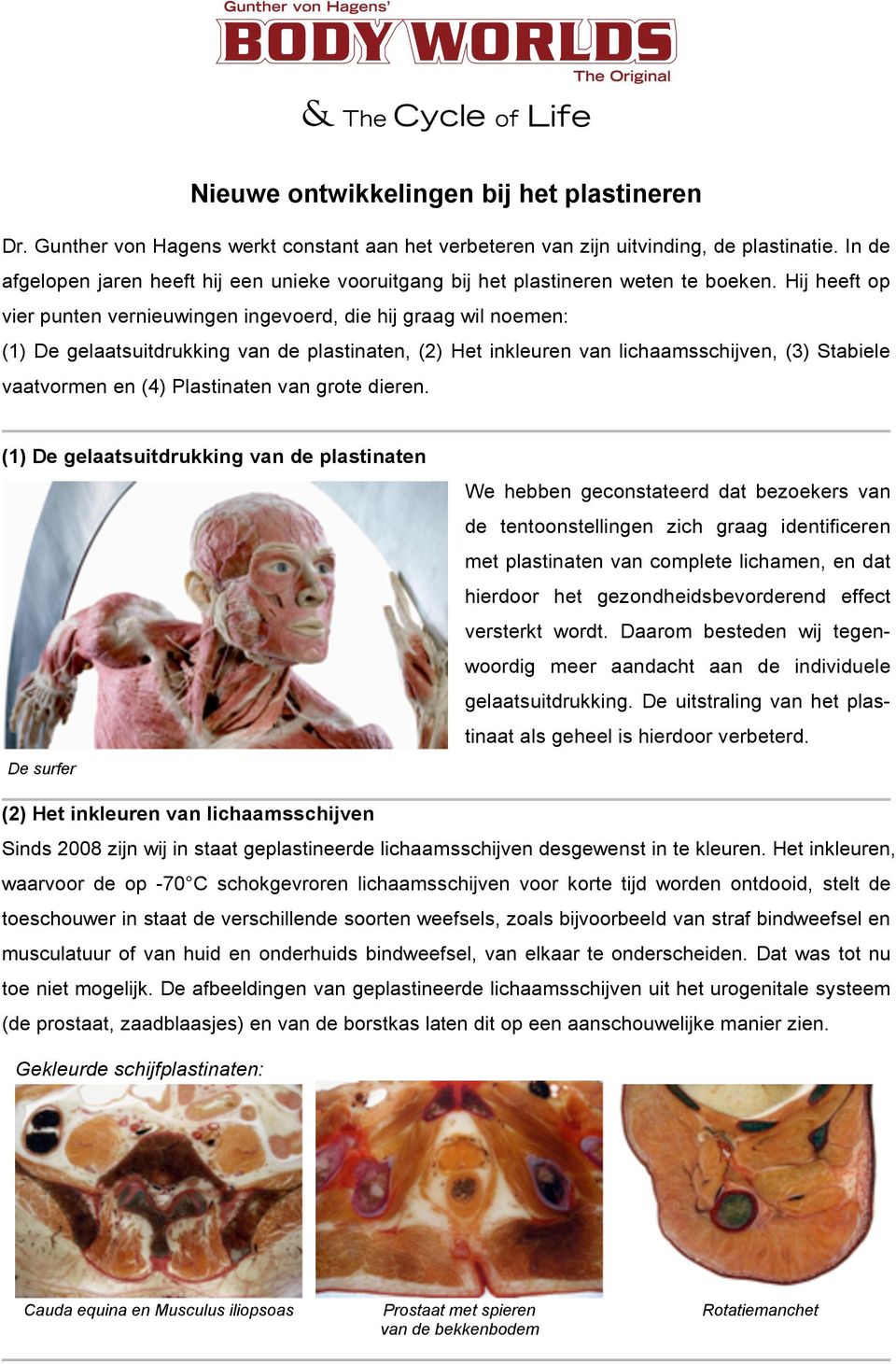 Hij heeft op vier punten vernieuwingen ingevoerd, die hij graag wil noemen: (1) De gelaatsuitdrukking van de plastinaten, (2) Het inkleuren van lichaamsschijven, (3) Stabiele vaatvormen en (4)