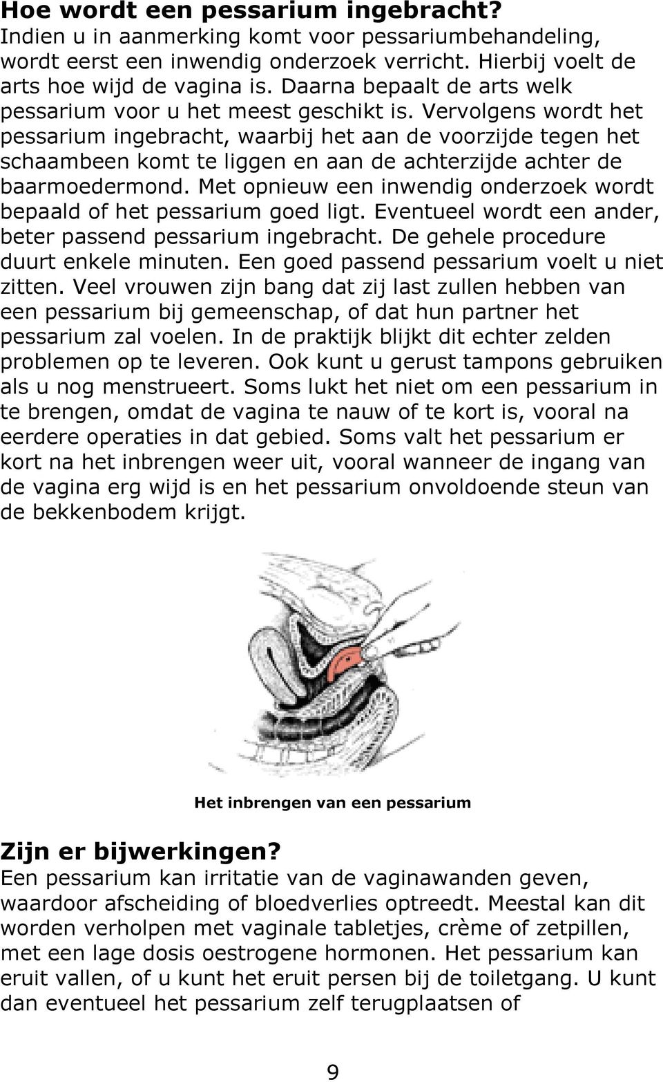 Vervolgens wordt het pessarium ingebracht, waarbij het aan de voorzijde tegen het schaambeen komt te liggen en aan de achterzijde achter de baarmoedermond.