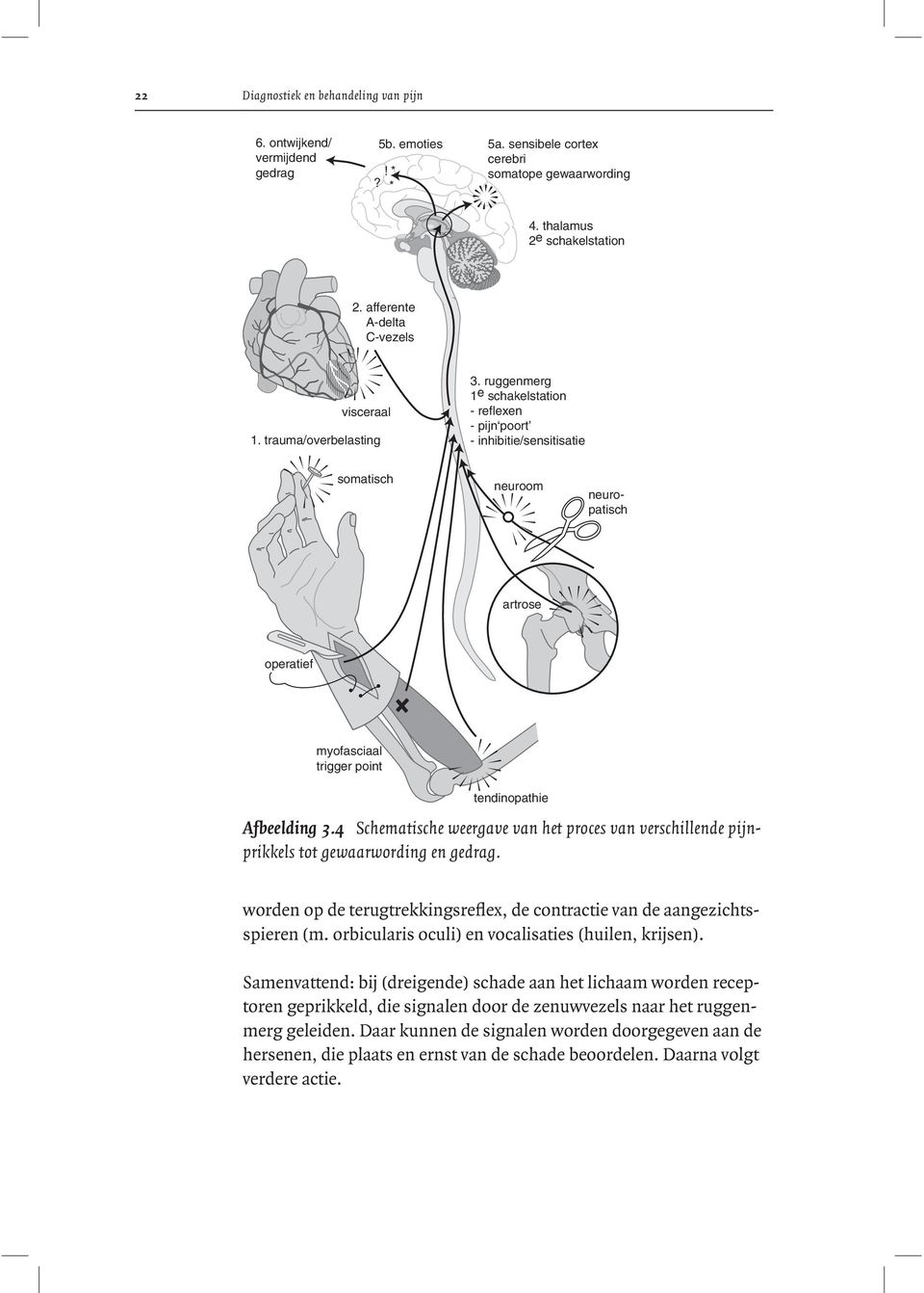 ruggenmerg 1 e schakelstation - reflexen - pijn poort - inhibitie/sensitisatie somatisch neuroom neuropatisch artrose operatief myofasciaal trigger point tendinopathie Afbeelding 3.