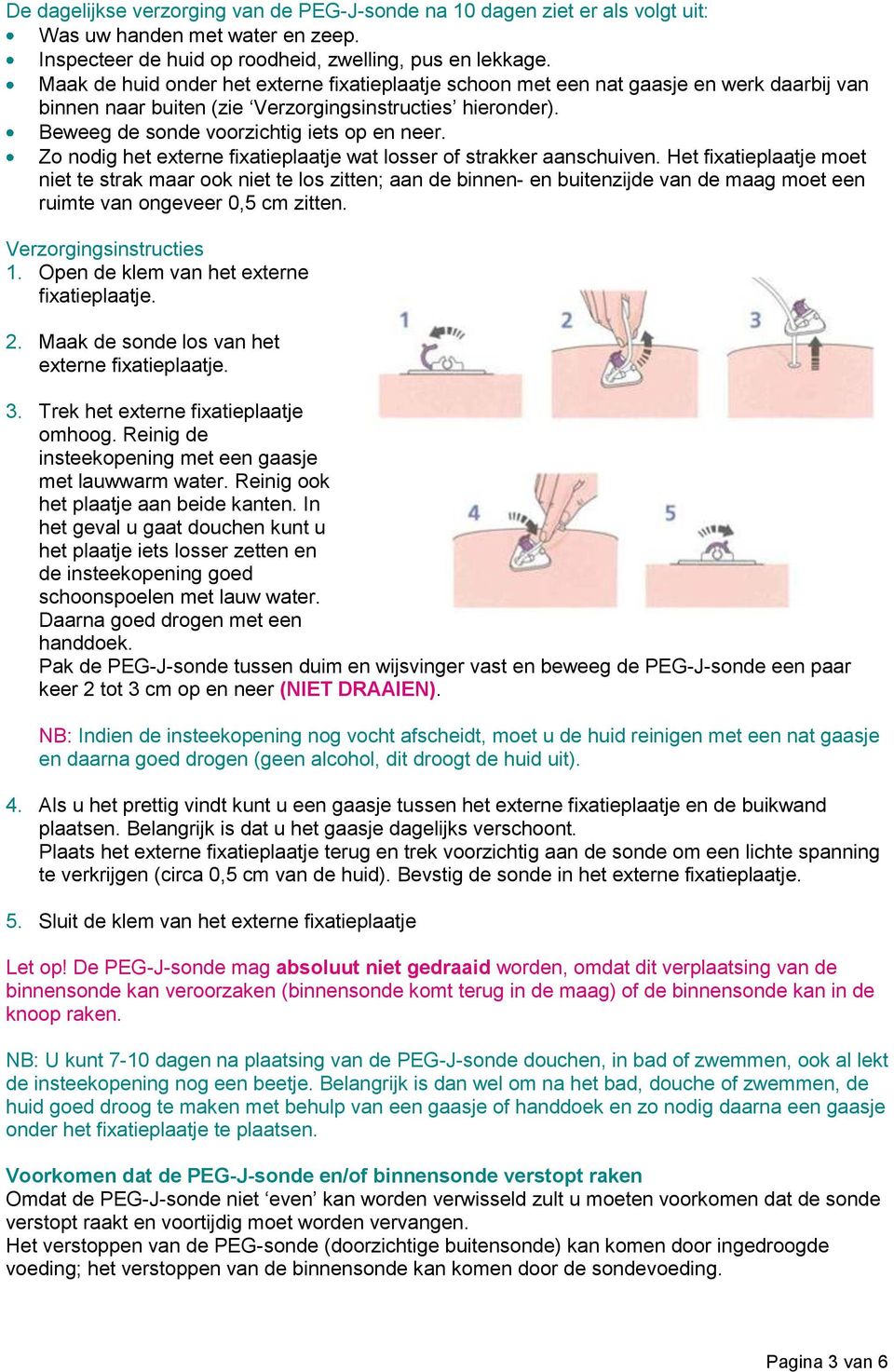 Zo nodig het externe fixatieplaatje wat losser of strakker aanschuiven.