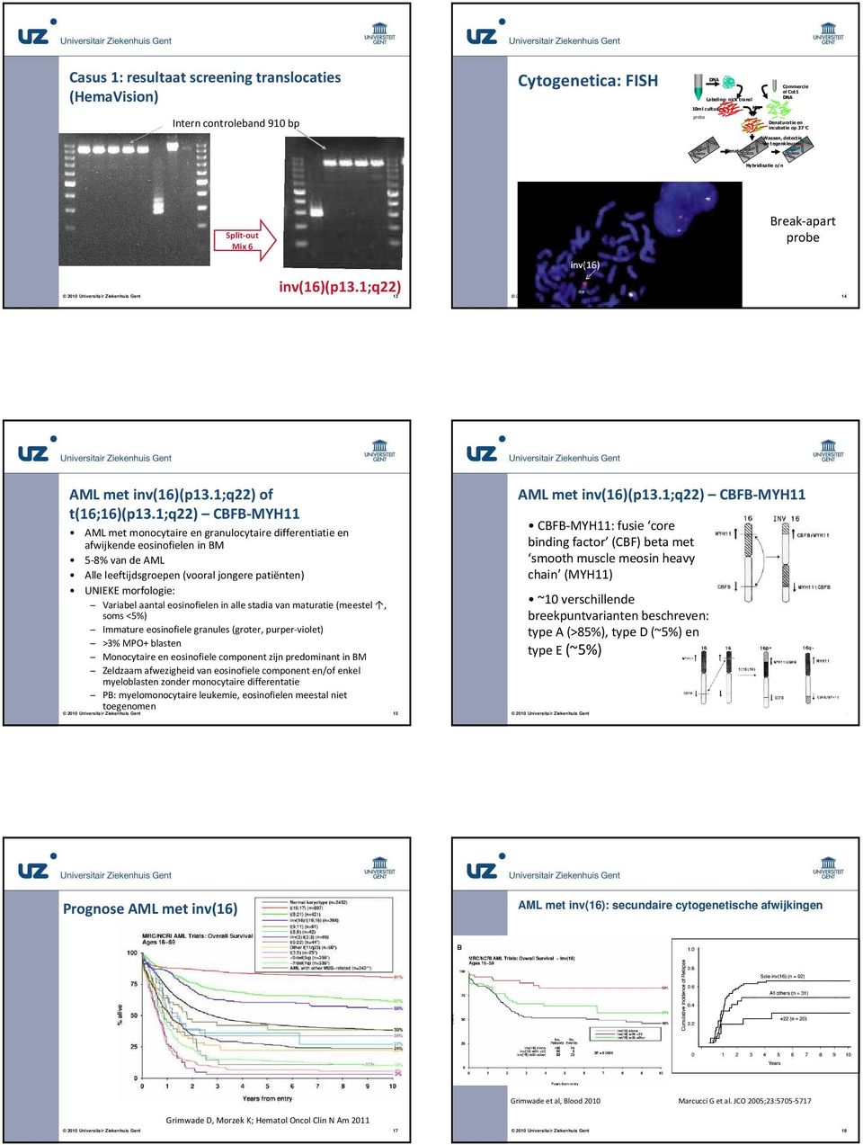 ;q22) CBFB-MYH AML met monocytaireen granulocytairedifferentiatie en afwijkende eosinofielen in BM -8% van de AML Alle leeftijdsgroepen (vooral jongere patiënten) UNIEKE morfologie: Variabel aantal