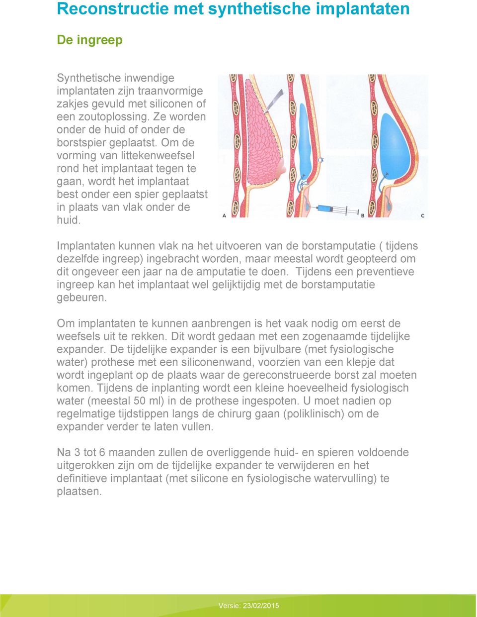 Om de vorming van littekenweefsel rond het implantaat tegen te gaan, wordt het implantaat best onder een spier geplaatst in plaats van vlak onder de huid.