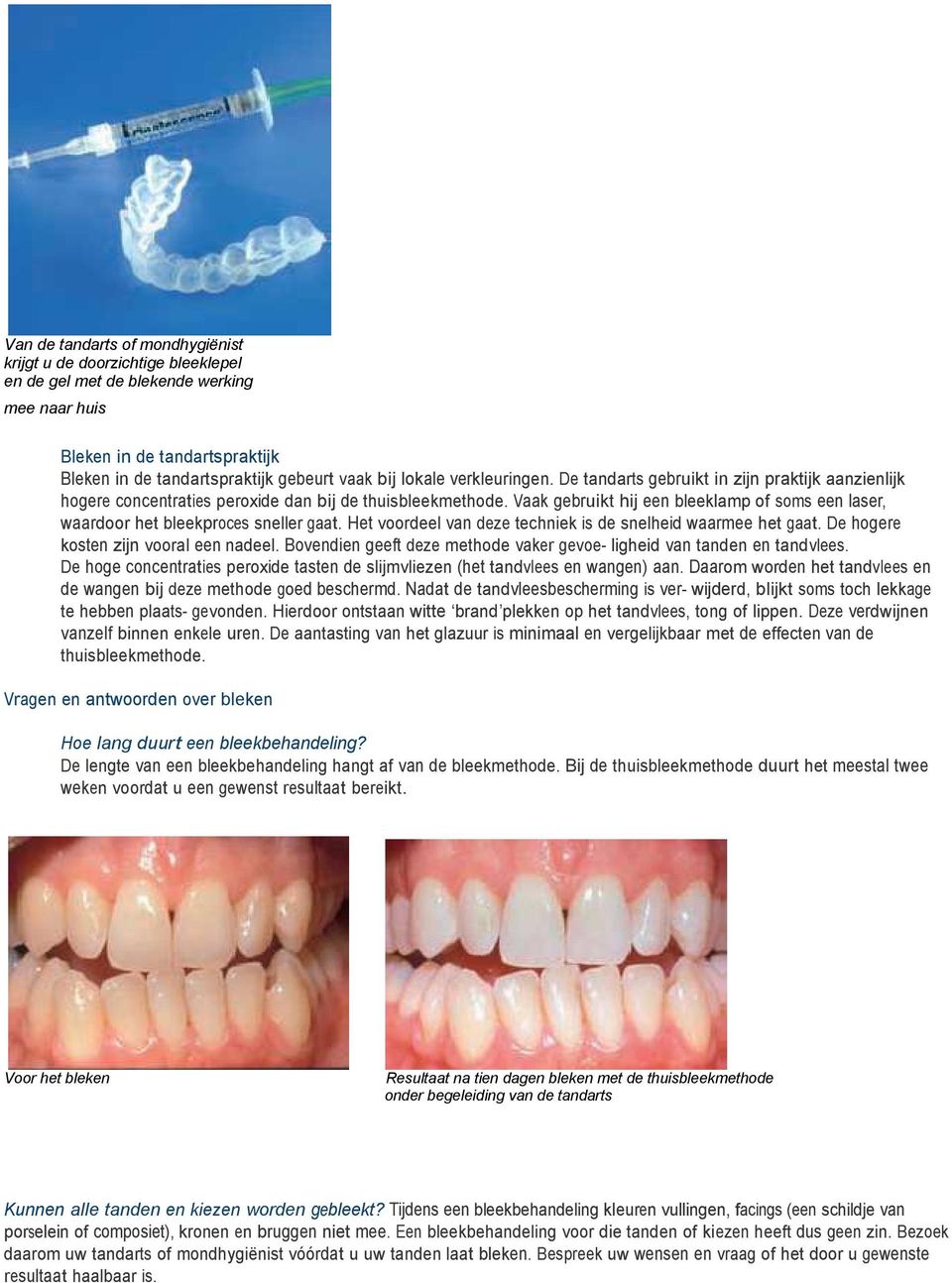 Vaak gebruikt hij een bleeklamp of soms een laser, waardoor het bleekproces sneller gaat. Het voordeel van deze techniek is de snelheid waarmee het gaat. De hogere kosten zijn vooral een nadeel.