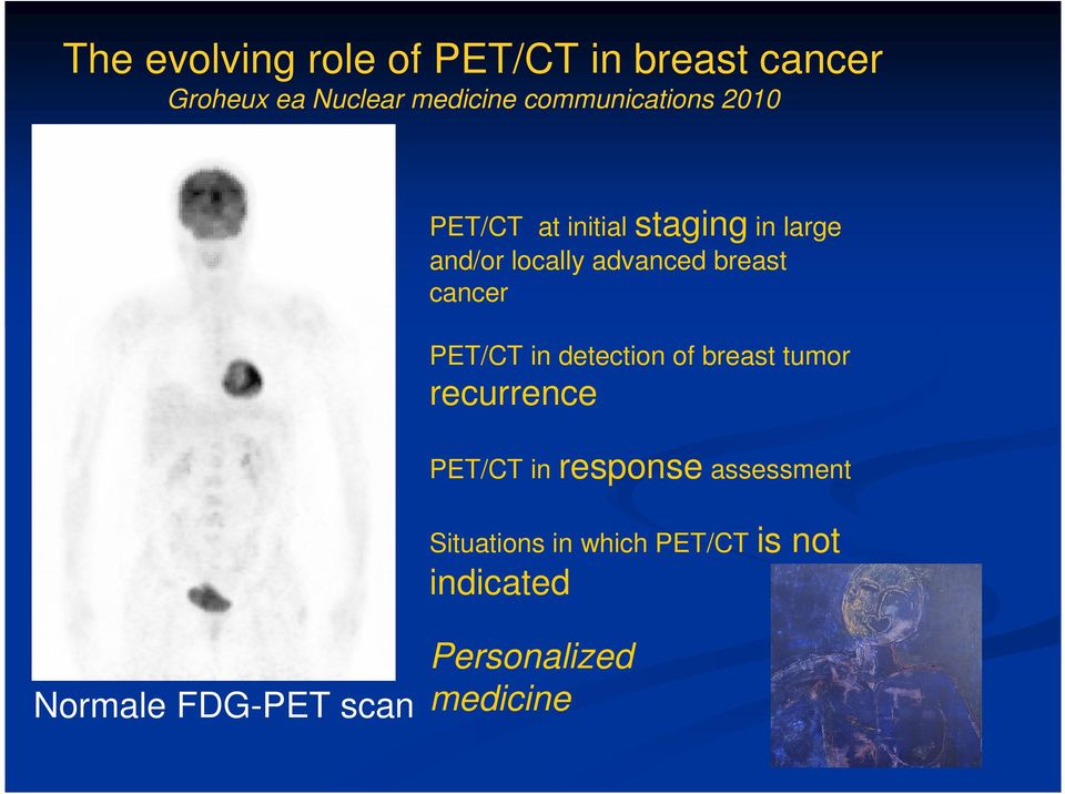 breast cancer PET/CT in detection of breast tumor recurrence PET/CT in response