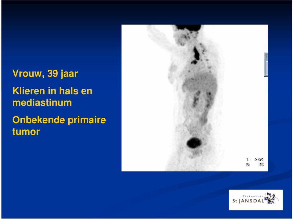 en mediastinum