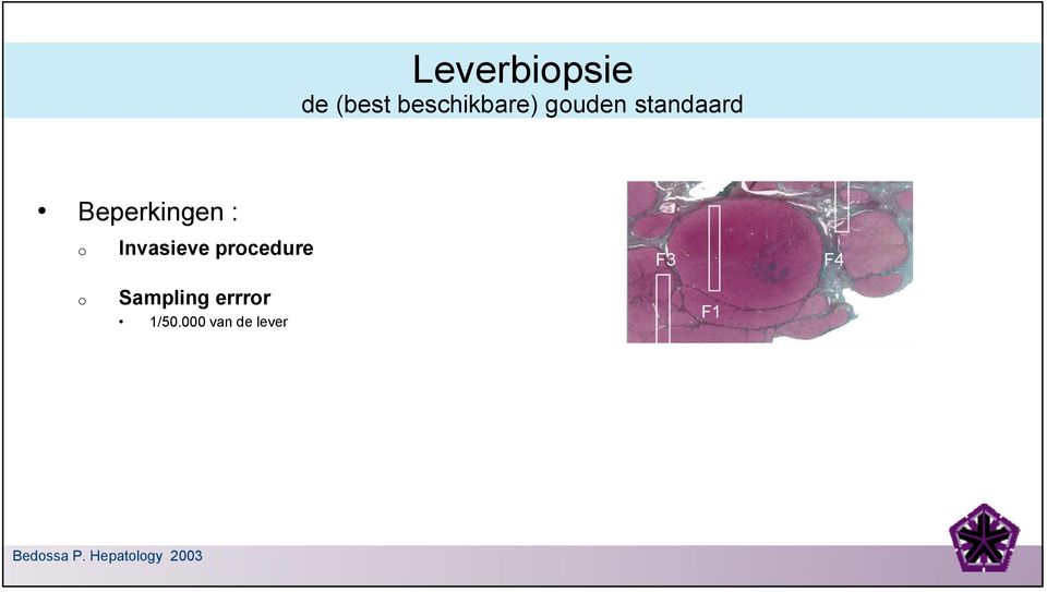 Invasieve procedure F3 F4 o Sampling