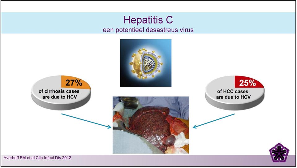 Hepatitis C een