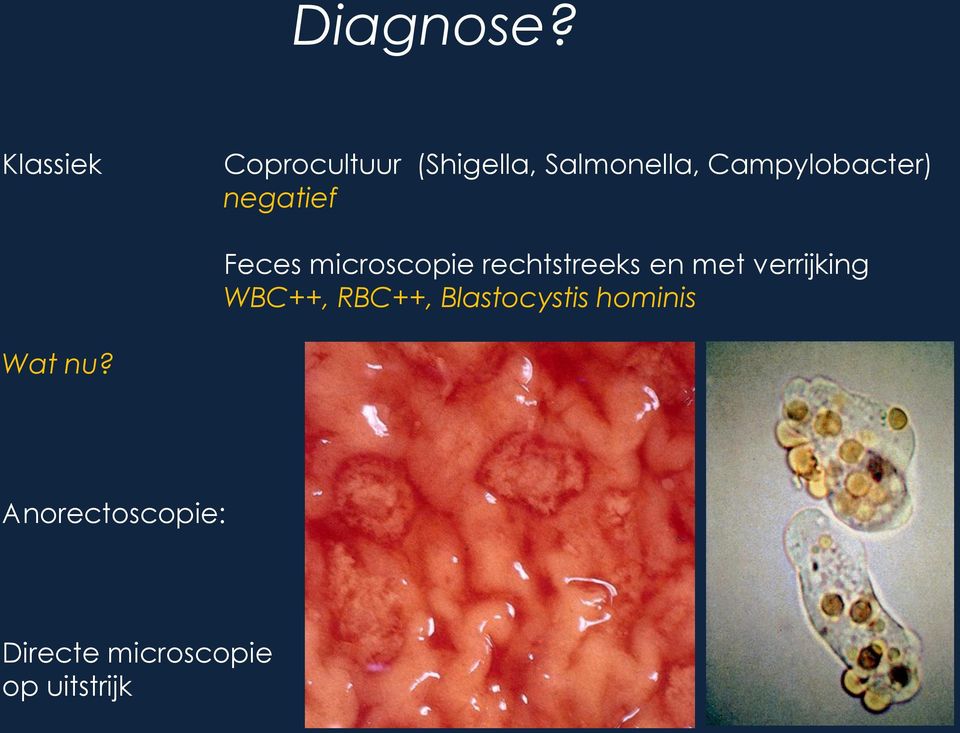 Campylobacter) negatief Feces microscopie rechtstreeks