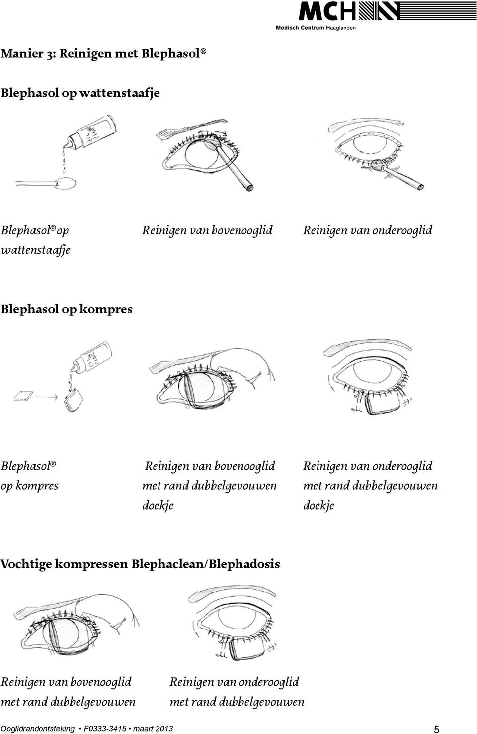 met rand dubbelgevouwen met rand dubbelgevouwen doekje doekje Vochtige kompressen Blephaclean/Blephadosis Reinigen van