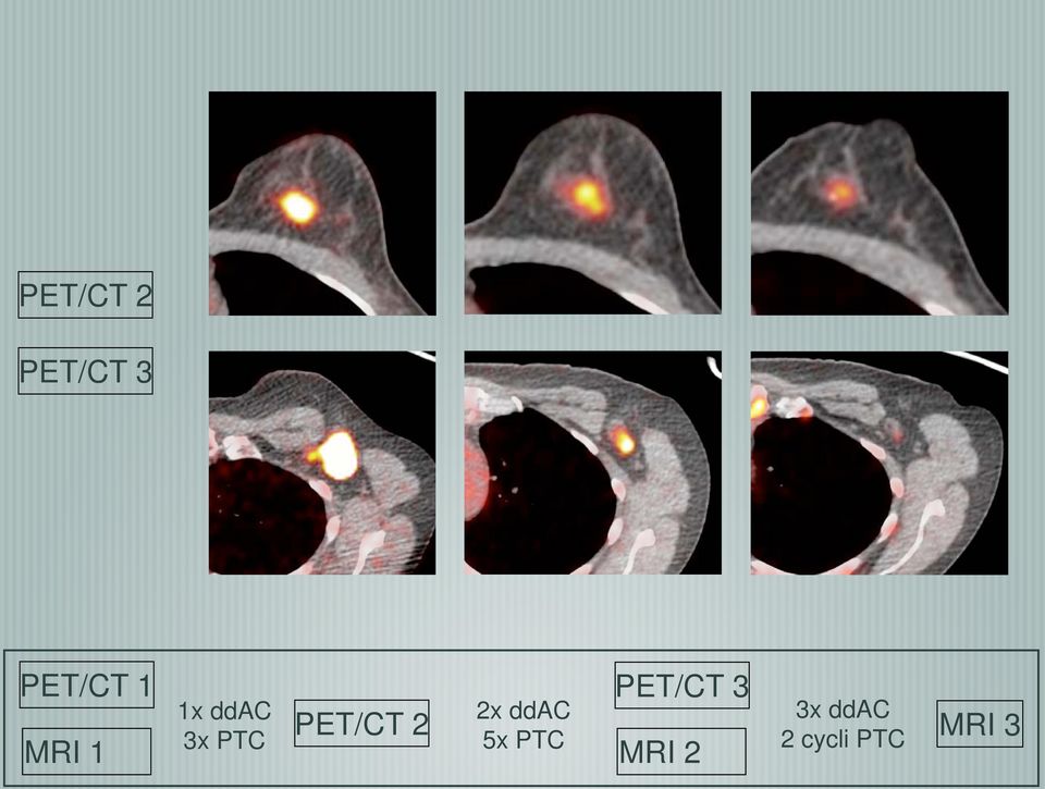 PET/CT 2 3x PTC 5x PTC MRI