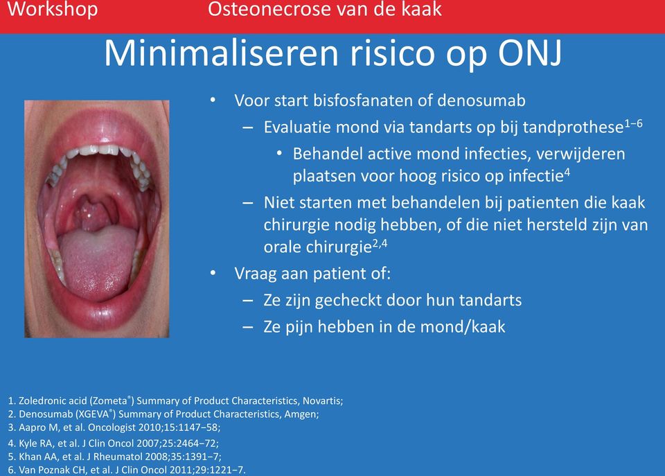 door hun tandarts Ze pijn hebben in de mond/kaak 1. Zoledronic acid (Zometa ) Summary of Product Characteristics, Novartis; 2.
