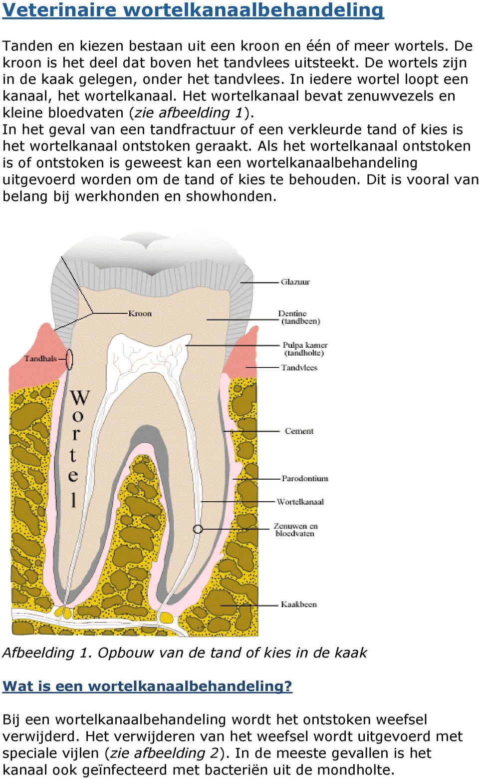 In het geval van een tandfractuur of een verkleurde tand of kies is het wortelkanaal ontstoken geraakt.