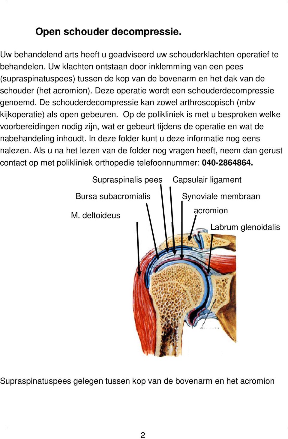 De schouderdecompressie kan zowel arthroscopisch (mbv kijkoperatie) als open gebeuren.