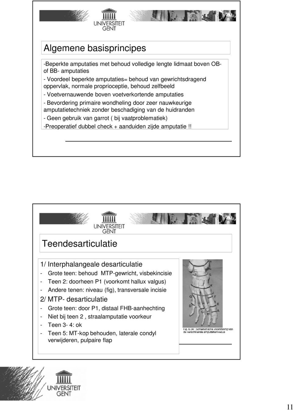 Geen gebruik van garrot ( bij vaatproblematiek) -Preoperatief dubbel check + aanduiden zijde amputatie!