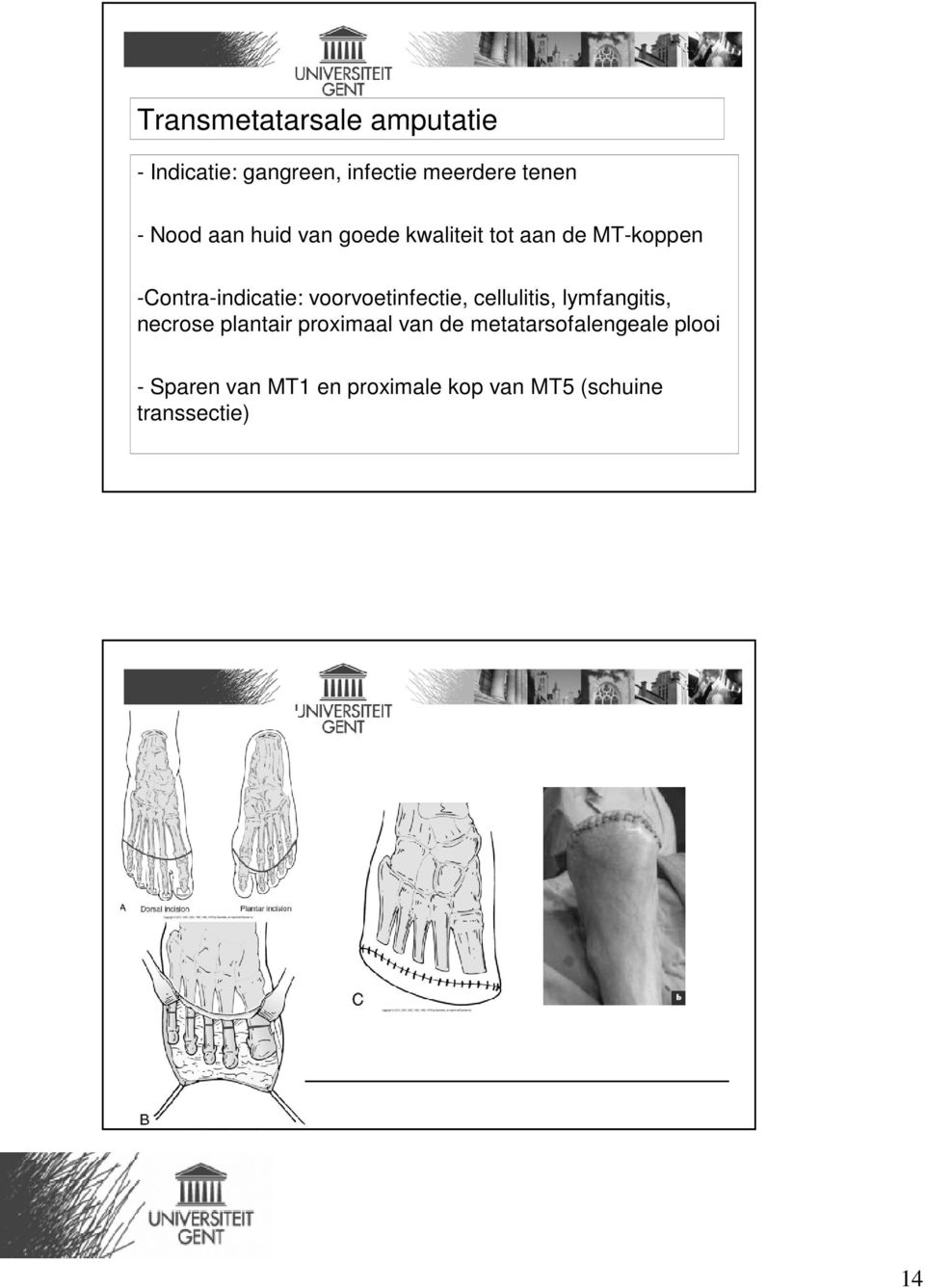 voorvoetinfectie, cellulitis, lymfangitis, necrose plantair proximaal van de