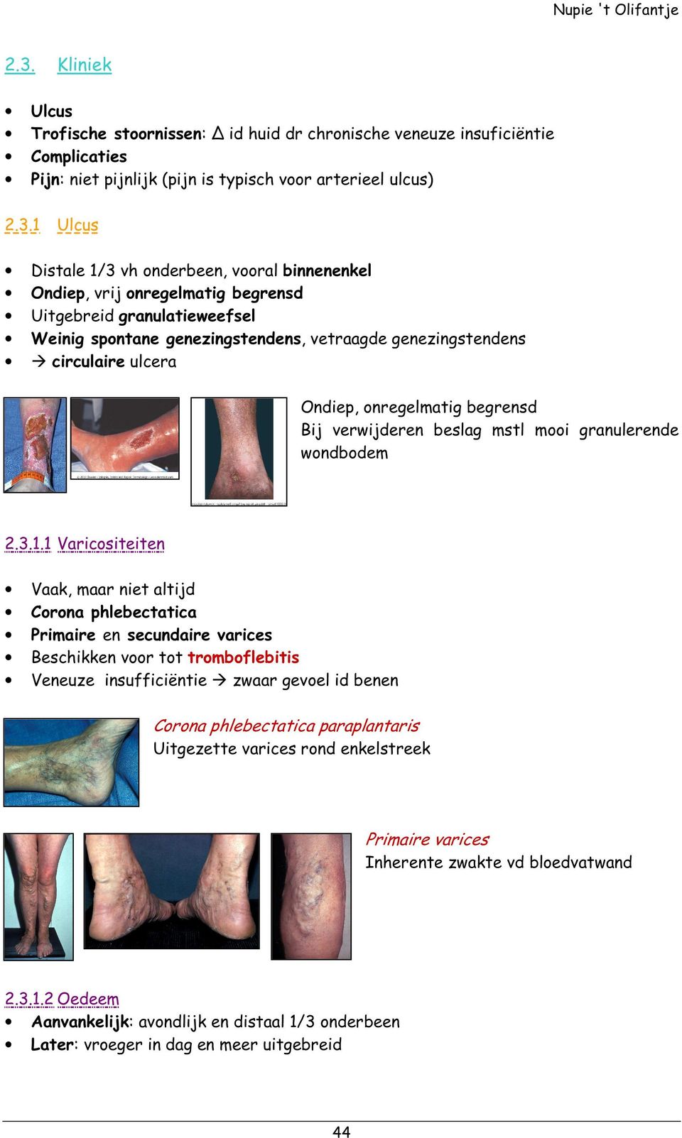 verwijderen beslag mstl mooi granulerende wondbodem 2.3.1.