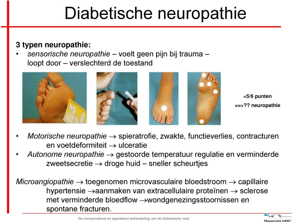 gestoorde temperatuur regulatie en verminderde zweetsecretie droge huid sneller scheurtjes Microangiopathie toegenomen microvasculaire