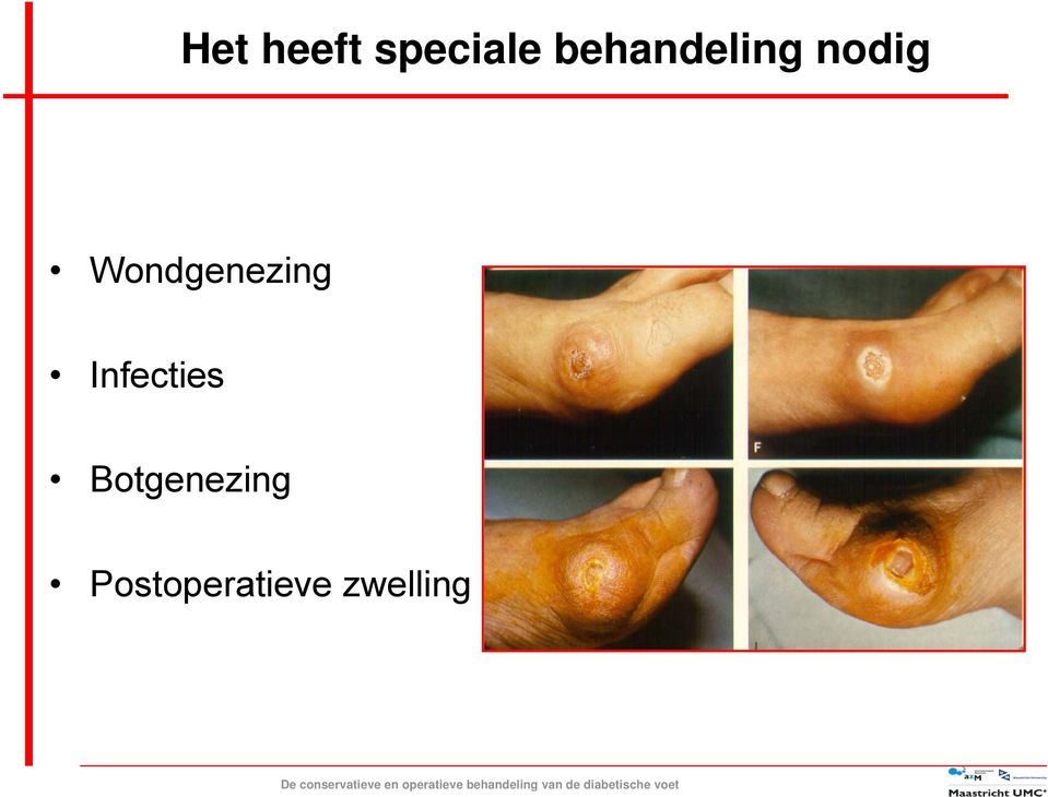 Wondgenezing Infecties