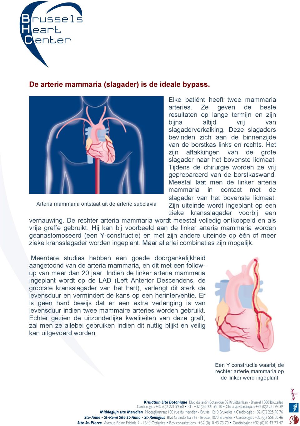 Tijdens de chirurgie worden ze vrij geprepareerd van de borstkaswand. Meestal laat men de linker arteria mammaria in contact met de slagader van het bovenste lidmaat.