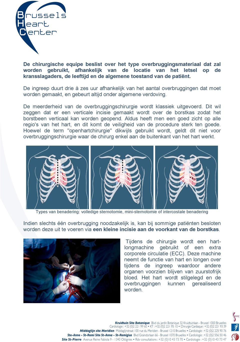 De meerderheid van de overbruggingschirurgie wordt klassiek uitgevoerd. Dit wil zeggen dat er een verticale incisie gemaakt wordt over de borstkas zodat het borstbeen verticaal kan worden geopend.