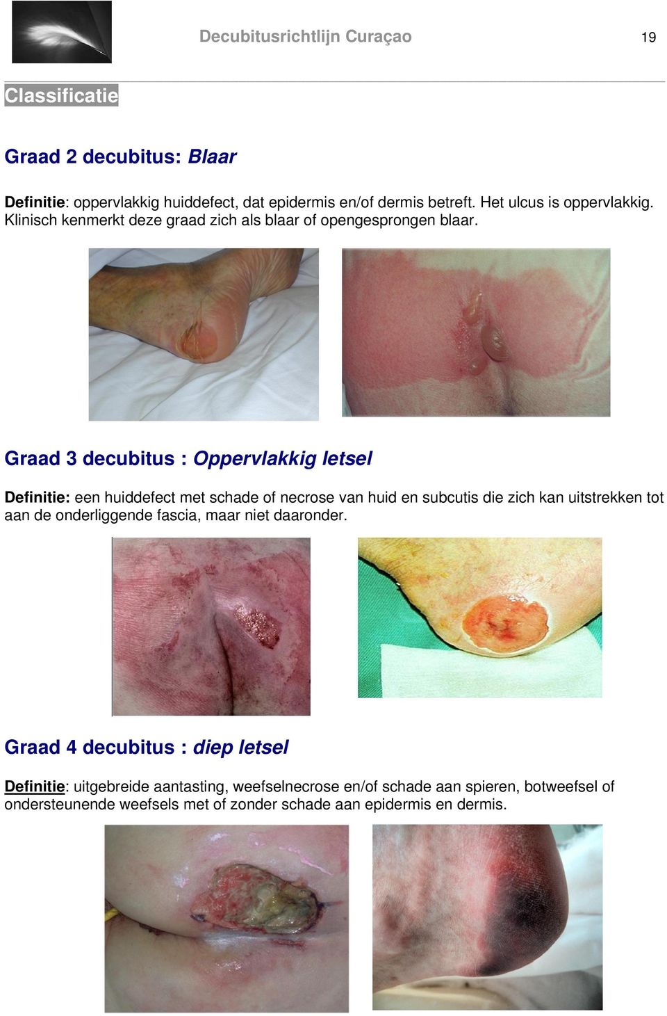 Graad 3 decubitus : Oppervlakkig letsel Definitie: een huiddefect met schade of necrose van huid en subcutis die zich kan uitstrekken tot aan de
