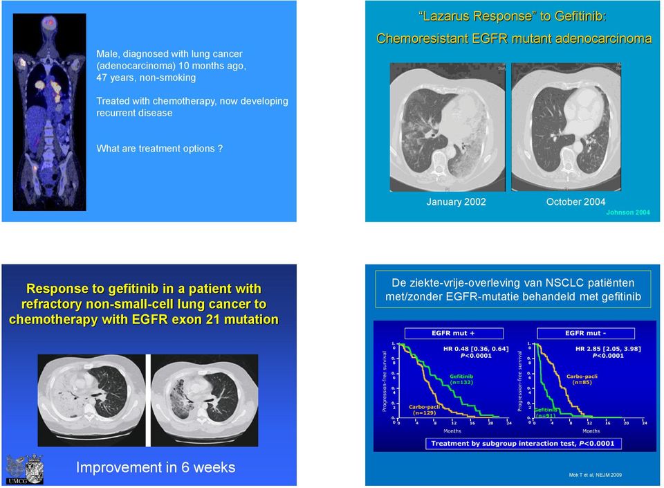 January 2002 October 2004 Johnson 2004 Response to gefitinib in a patient with refractory non-small-cell lung cancer to chemotherapy with