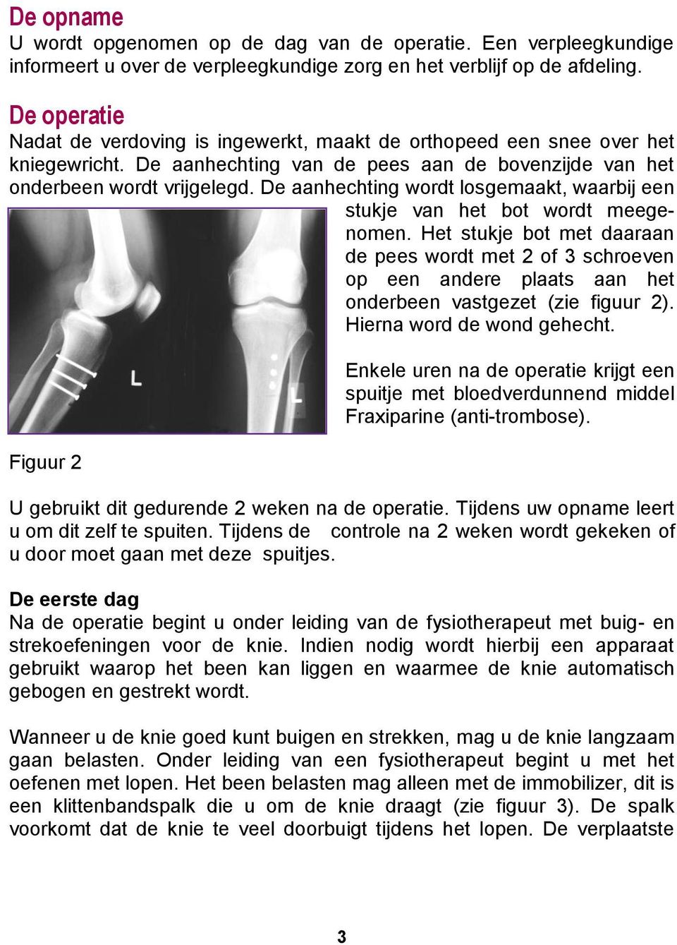 De aanhechting wordt losgemaakt, waarbij een stukje van het bot wordt meegenomen.