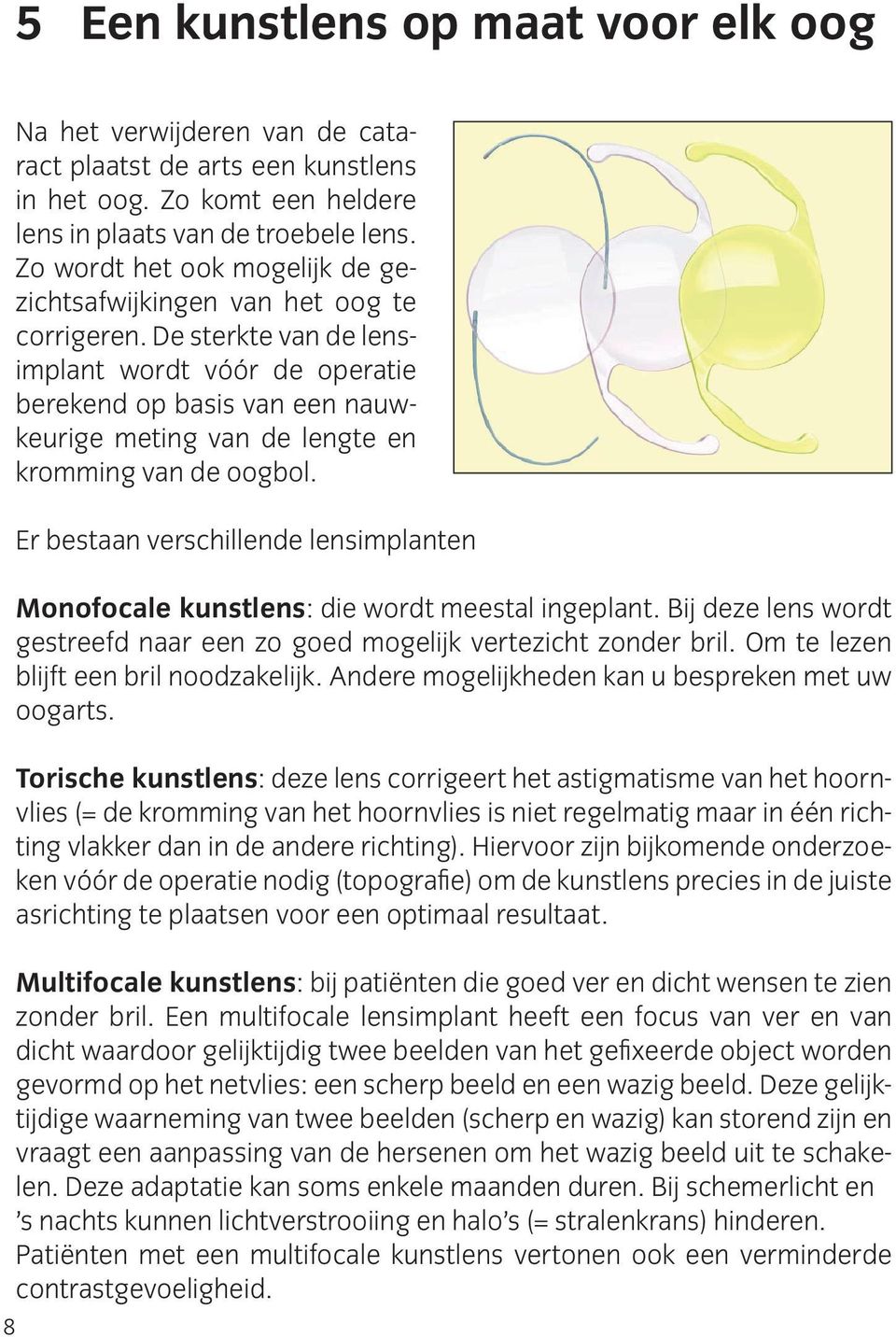 De sterkte van de lensimplant wordt vóór de operatie berekend op basis van een nauwkeurige meting van de lengte en kromming van de oogbol.