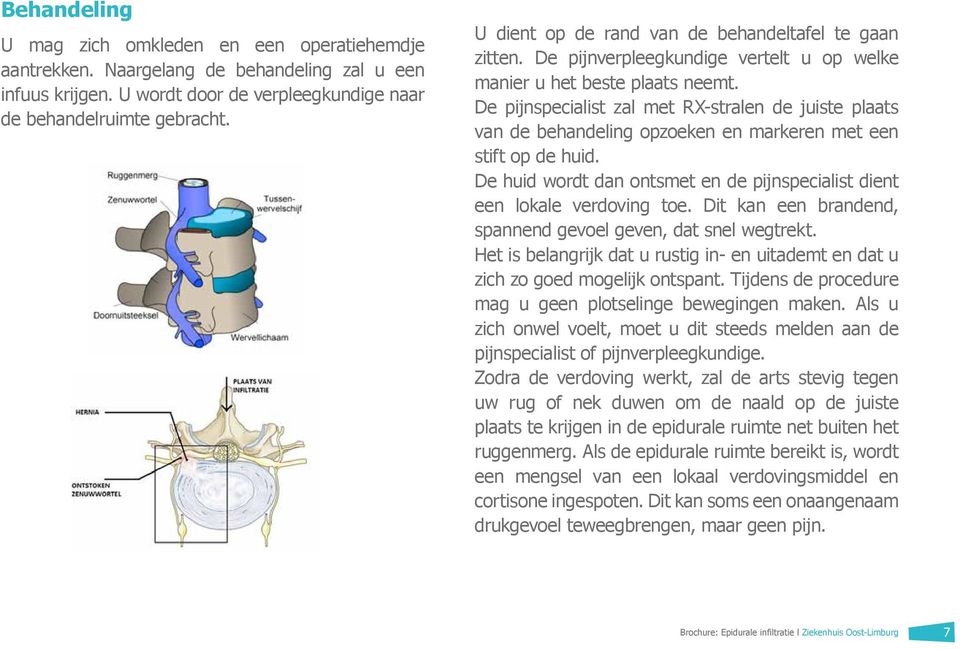 De pijnspecialist zal met RX-stralen de juiste plaats van de behandeling opzoeken en markeren met een stift op de huid. De huid wordt dan ontsmet en de pijnspecialist dient een lokale verdoving toe.