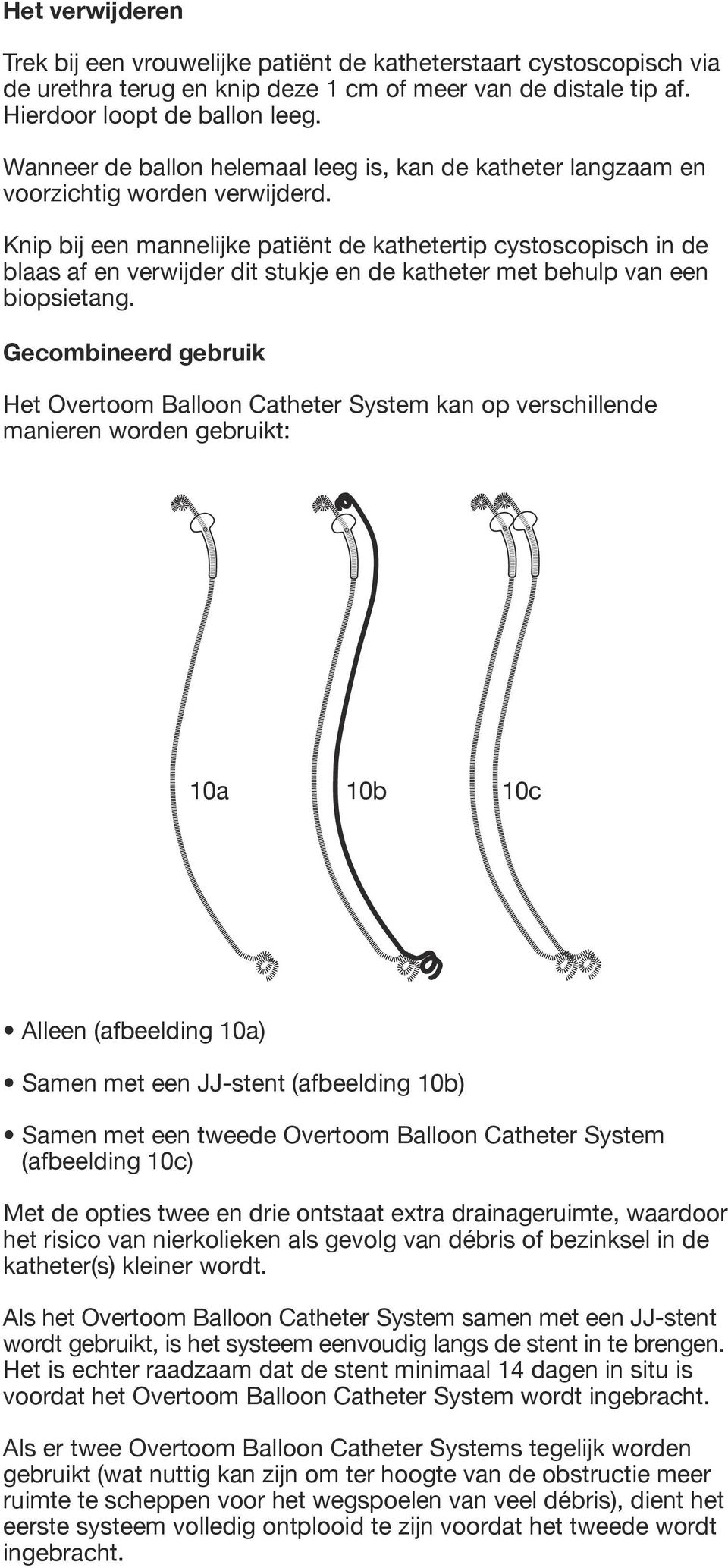 Knip bij een mannelijke patiënt de kathetertip cystoscopisch in de blaas af en verwijder dit stukje en de katheter met behulp van een biopsietang.