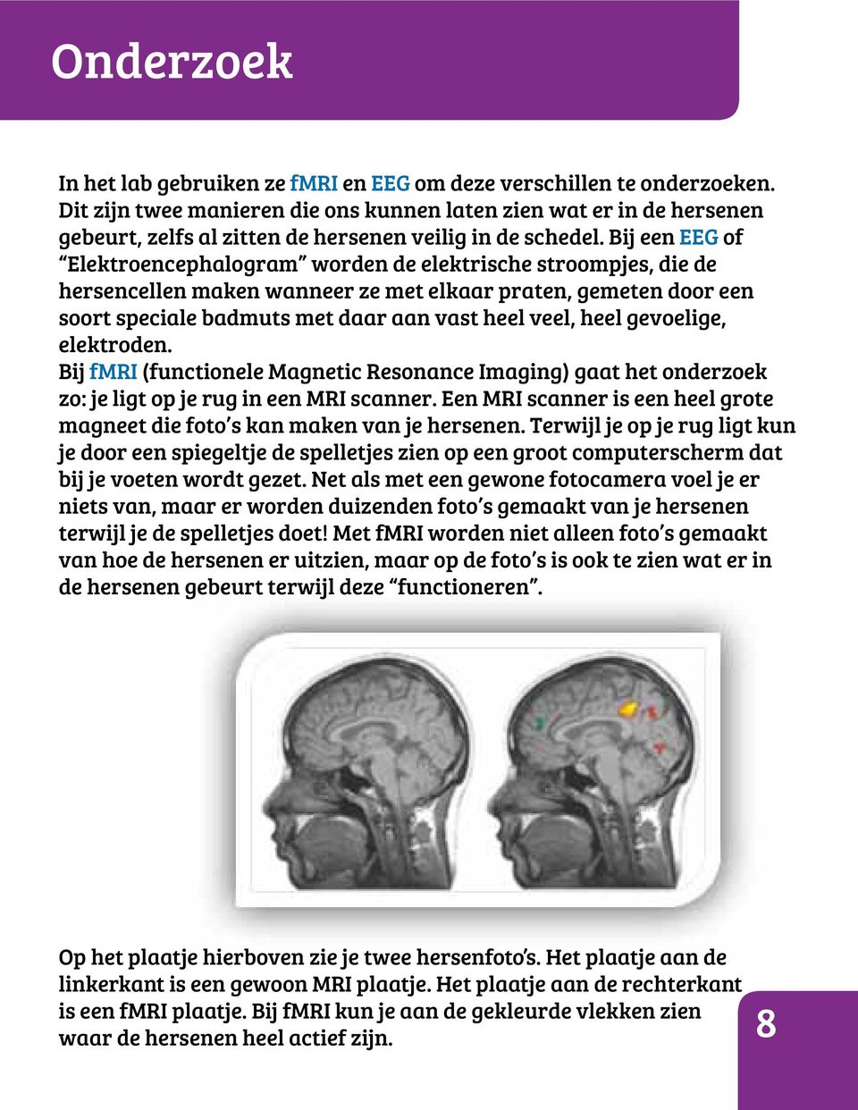 Bij een G of lektroencephalogram worden de elektrische stroompjes, die de hersencellen maken wanneer ze met elkaar praten, gemeten door een soort speciale badmuts met daar aan vast heel veel, heel