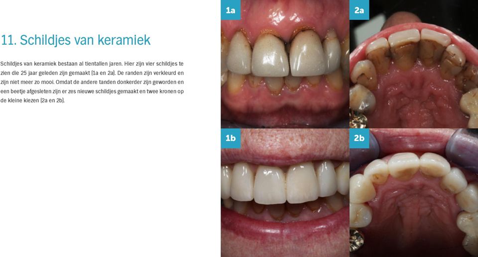 Innovatieve tandheelkundige oplossingen door een interdisciplinaire aanpak.  - PDF Gratis download
