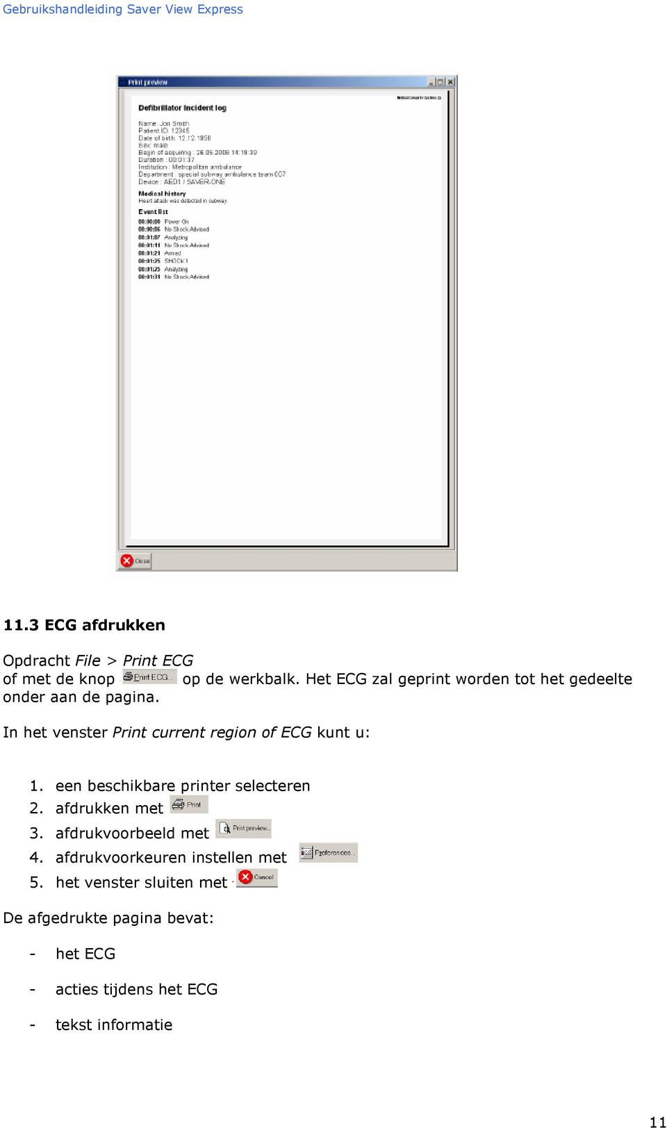 In het venster Print current region of ECG kunt u: 1. een beschikbare printer selecteren 2.