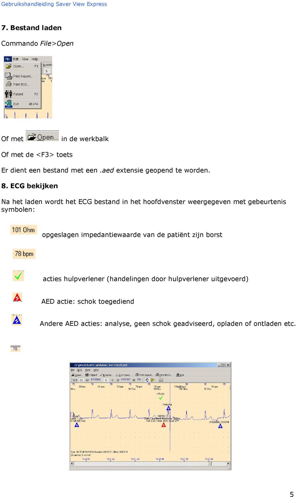 ECG bekijken Na het laden wordt het ECG bestand in het hoofdvenster weergegeven met gebeurtenis symbolen: opgeslagen