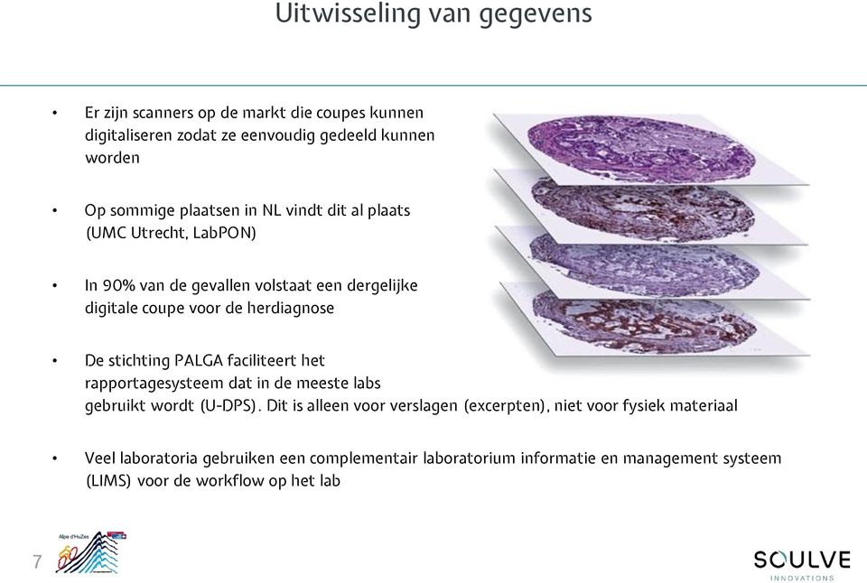 stichting PALGA faciliteert het rapportagesysteem dat in de meeste labs gebruikt wordt (U-DPS).