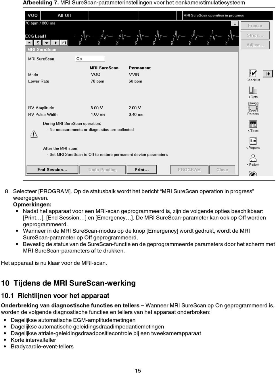 De MRI SureScan-parameter kan ook op Off worden geprogrammeerd. Wanneer in de MRI SureScan-modus op de knop [Emergency] wordt gedrukt, wordt de MRI SureScan-parameter op Off geprogrammeerd.