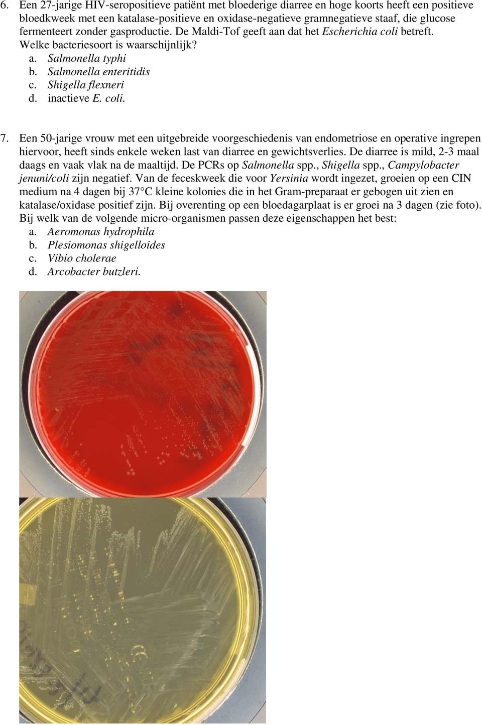 inactieve E. coli. 7. Een 50-jarige vrouw met een uitgebreide voorgeschiedenis van endometriose en operative ingrepen hiervoor, heeft sinds enkele weken last van diarree en gewichtsverlies.