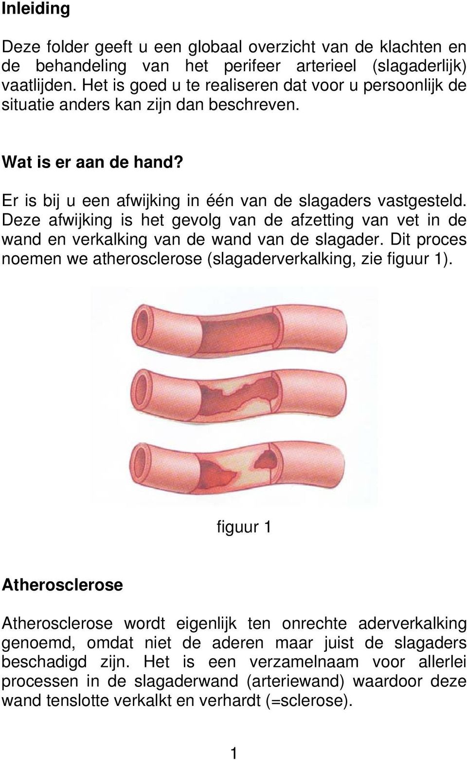 Deze afwijking is het gevolg van de afzetting van vet in de wand en verkalking van de wand van de slagader. Dit proces noemen we atherosclerose (slagaderverkalking, zie figuur 1).